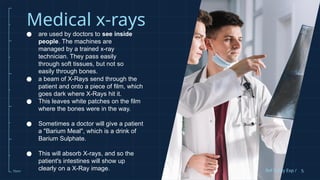 Group six_X-ray presentation.pptx_finals | PPTX