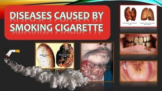 Smoking Cigarette