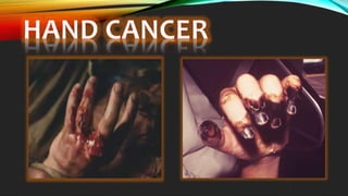 Smoking Cigarette