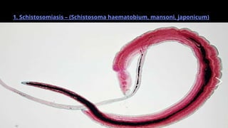 Common Helminthic Infections for medical stuents | PPTX