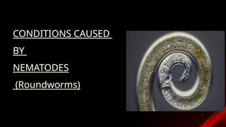 Common Helminthic Infections for medical stuents | PPTX