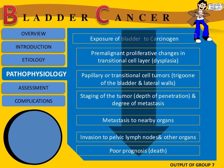 Bladder cancer by section Watson G7