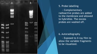 5. Probe labelling
- Complementary
radioactive probes are added
to the membrane and allowed
to hybridize. The excess
probes are washed off.
6. Autoradiography
- Exposed to X-ray film to
allow the variable fragments
to be visualized.
 