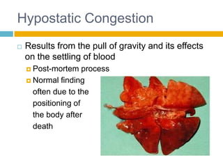 Hypostatic Congestion
   Results from the pull of gravity and its effects
    on the settling of blood
     Post-mortem    process
     Normal finding

      often due to the
      positioning of
      the body after
      death
 