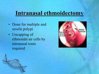 Intranasal ethmoidectomy
• Done for multiple and
  sessile polypi
• Uncapping of
  ethmoidal air cells by
  intranasal route
  required
 