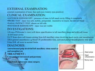 EXTERNAL EXAMINATION:
external examination of nose, face and eyes (watery eyes positive)
CLINICAL EXAMINATION:
•ANTERIOR RHINOSCOPY : presence of mass in left nasal cavity filling it completely
•PROBE TEST : mass was soft, mobile, polypoidal, insensitive to touch, but did not bleed
•NASAL PATENCY TEST: absent on left side
•POSTERIOR RHINOSCOPY : mass was not visible
INVESTIGATIONS:
1)X-rays PNS(water’s view) will show opacification in left maxillary sinus and with soft tissue
in left nasal cavity.
2) CT Scan show soft tissues arising from left maxillary sinus involving nasal cavity and nasopharynx
3)For general anaesthesia e.g blood CP, prothrombin time, activated partial thromboplastin time and
Urine D/R :all were in normal limits
DIAGNOSIS:
Antrochoanal polp involvinf left maxillary sinus nasal cavity
and nasopharynx
TREATMENT :
Convensional intranasal polypectomy
                  OR
Functional endoscopic sinus surgery
 
