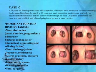 CASE -2
   A 28 years old female patient came with complaints of bilateral nasal obstruction ,excessive sneezing
   And watery rhinorrhoea for past 8 to 10 years now nasal obstruction has increased markedly to
   become almost continuous and she can not breath through her nose. On clinical examination the
   nose was pale, multiple and bilateral polypi were present in nasal cavities.

•IMPORTANT POINTS IN
HISTORY TAKING:
•Nasal obstruction
(onset, duration, progression, u
nilateral or
bilateral, continuous or
intermittent, aggravating and
relieving factors)
•Nasal discharge(colour
,frequency, consistency)
•Allergy or asthma, excessive
sneezing, watery
rhinorrhea, dyspnoea
•Watering from eyes
•Nasal surgery
 