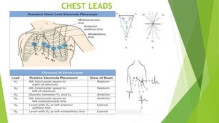 CHEST LEADS
 