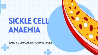 SICKLE CELL
ANAEMIA
EARLY CLINICAL EXPOSURE (ECE)
 