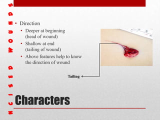 Characters
• Direction
• Deeper at beginning
(head of wound)
• Shallow at end
(tailing of wound)
• Above features help to know
the direction of wound
Tailing
 