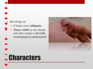 Characters
• Beveling cut
• If blade enters obliquely
• Tissue visible at one margin
and other margin is beveled
(overhanging or undermined)
 
