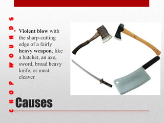 Causes
• Violent blow with
the sharp-cutting
edge of a fairly
heavy weapon, like
a hatchet, an axe,
sword, broad heavy
knife, or meat
cleaver
 