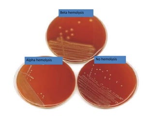 CAMP test showing half-moon shaped zone of complete hemolysis on a