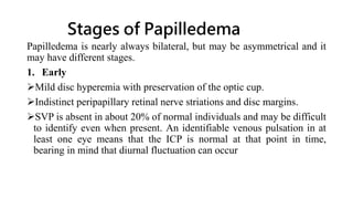 Stages of Papilledema
Papilledema is nearly always bilateral, but may be asymmetrical and it
may have different stages.
1. Early
Mild disc hyperemia with preservation of the optic cup.
Indistinct peripapillary retinal nerve striations and disc margins.
SVP is absent in about 20% of normal individuals and may be difficult
to identify even when present. An identifiable venous pulsation in at
least one eye means that the ICP is normal at that point in time,
bearing in mind that diurnal fluctuation can occur
 