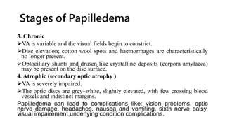 Stages of Papilledema
3. Chronic
VA is variable and the visual fields begin to constrict.
Disc elevation; cotton wool spots and haemorrhages are characteristically
no longer present.
Optociliary shunts and drusen-like crystalline deposits (corpora amylacea)
may be present on the disc surface.
4. Atrophic (secondary optic atrophy )
VA is severely impaired.
The optic discs are grey–white, slightly elevated, with few crossing blood
vessels and indistinct margins.
Papilledema can lead to complications like: vision problems, optic
nerve damage, headaches, nausea and vomiting, sixth nerve palsy,
visual impairement,underlying condition complications.
 