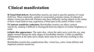 Clinical manifestation
4.Visual field defects: Retrobulbar neuritis can lead to specific patterns of visual
field loss. Most commonly, central or cecocentral scotomas (areas of reduced or
absent vision) are observed. Patients may have difficulty seeing objects in the center
of their visual field or may experience a blind spot in the center of their vision.
5.Contrast sensitivity reduction: Retrobulbar neuritis can affect contrast
sensitivity, making it difficult to distinguish between objects of similar brightness or
color.
6.Optic disc appearance: The optic disc, where the optic nerve exits the eye, may
appear normal during the early stages of retrobulbar neuritis. Unlike in papillitis
(inflammation at the optic nerve head), there may be no obvious swelling or disc
edema.
Retrobulbar neuritis has complications like: vision loss, color vision deficits and
impaired contrast sensitivity.
 