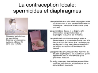 Contraception, diaporama du groupe 1 | PPT