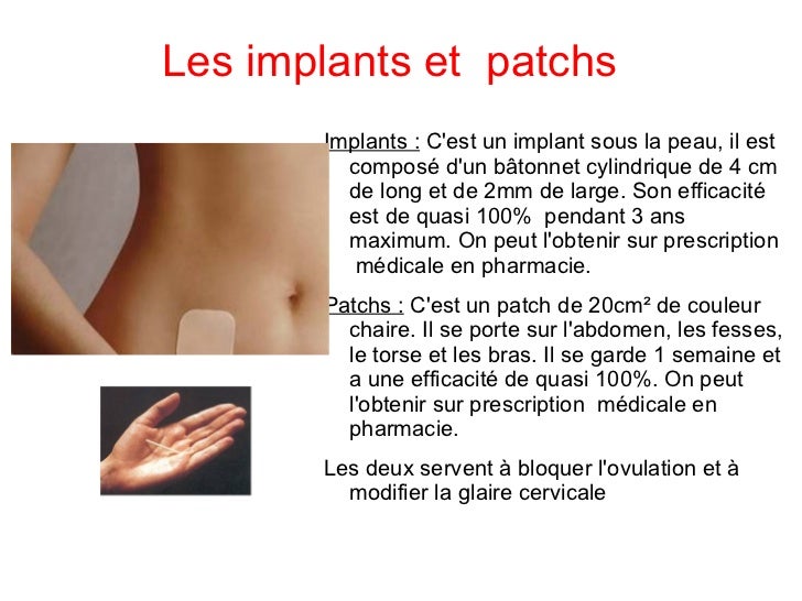 Contraception, diaporama du groupe 2