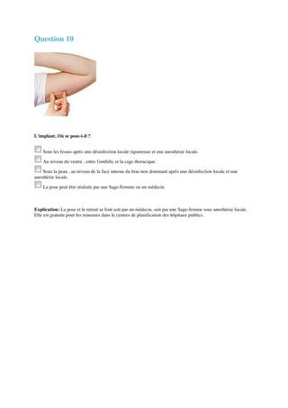 Question 10 
L'implant, Où se pose-t-il ? 
Sous les fesses après une désinfection locale rigoureuse et une anesthésie locale. 
Au niveau du ventre , entre l'ombilic et la cage thoracique. 
Sous la peau , au niveau de la face interne du bras non dominant après une désinfection locale et une 
anesthésie locale. 
La pose peut être réalisée par une Sage-Femme ou un médecin 
Explication: La pose et le retrait se font soit par un médecin, soit par une Sage-femme sous anesthésie locale. 
Elle est gratuite pour les mineures dans le centres de planification des hôpitaux publics. 
 