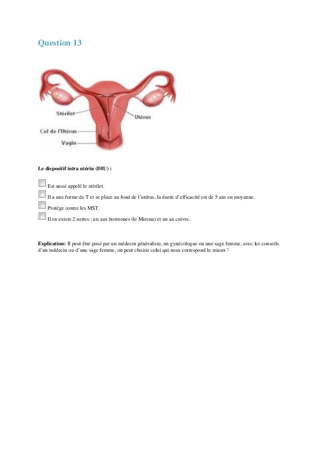 quiz contraception quiz contraception