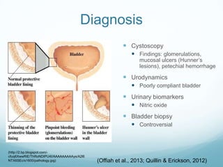 Interstitial Cystitis | PPTX