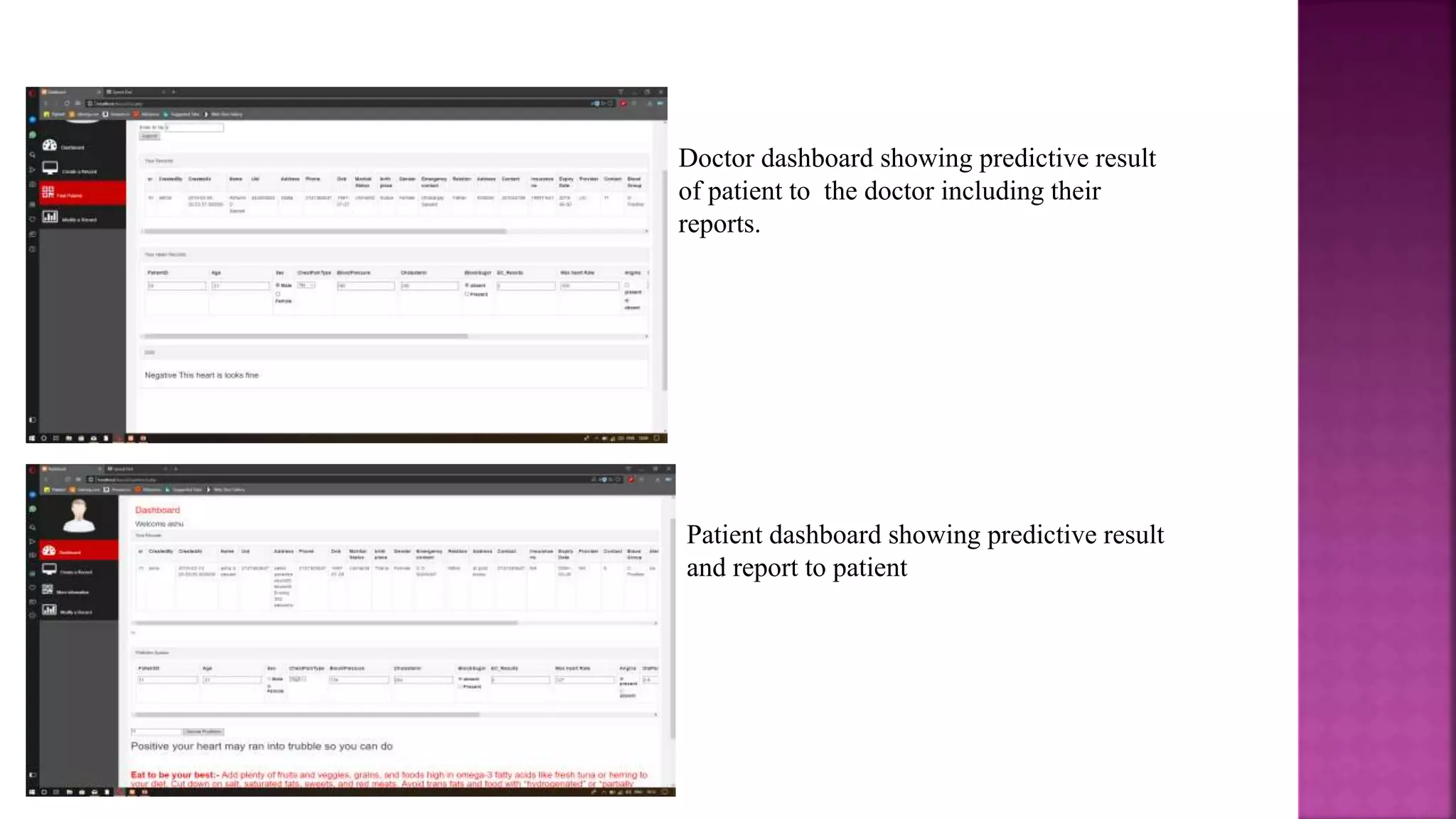 Doctor dashboard showing predictive result
of patient to the doctor including their
reports.
Patient dashboard showing predictive result
and report to patient
 
