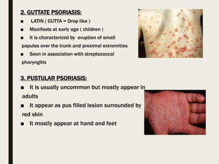 2. GUTTATE PSORIASIS:
■ LATIN ( GUTTA = Drop like )
■ Manifests at early age ( children )
■ It is characterized by eruption of small
papules over the trunk and proximal extremities
■ Seen in association with streptococcal
pharyngitis
3. PUSTULAR PSORIASIS:
■ It is usually uncommon but mostly appear in
adults
■ It appear as pus filled lesion surrounded by
red skin
■ It mostly appear at hand and feet
 