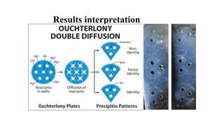 Results interpretation
 