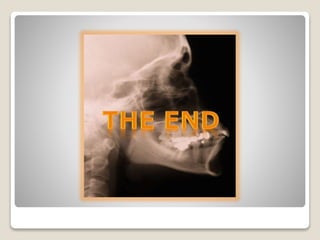 The Axial Skeleton & Appendicular Skeleton