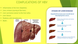 Presentation on hepatitis b virus infection | PPTX