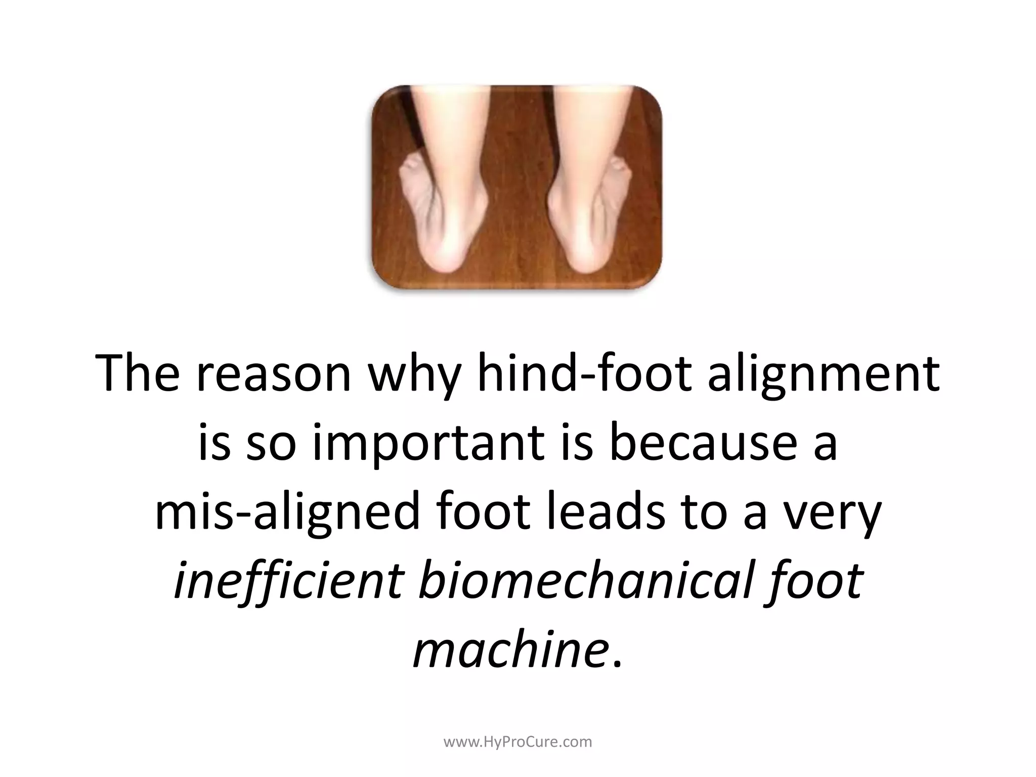 The reason why hind-foot alignment
is so important is because a
mis-aligned foot leads to a very
inefficient biomechanical foot
machine.
 