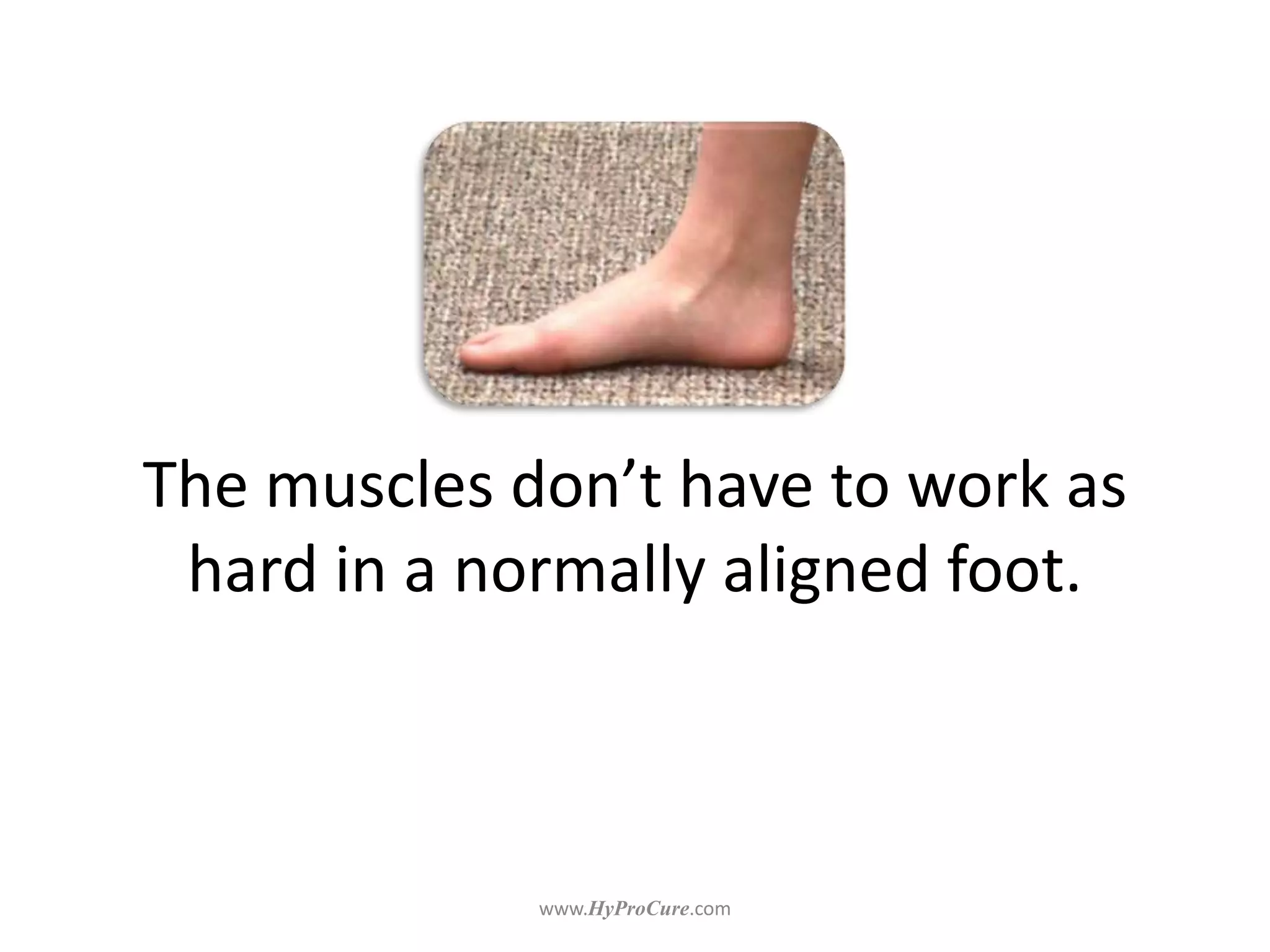 The muscles don’t have to work as
hard in a normally aligned foot.
 