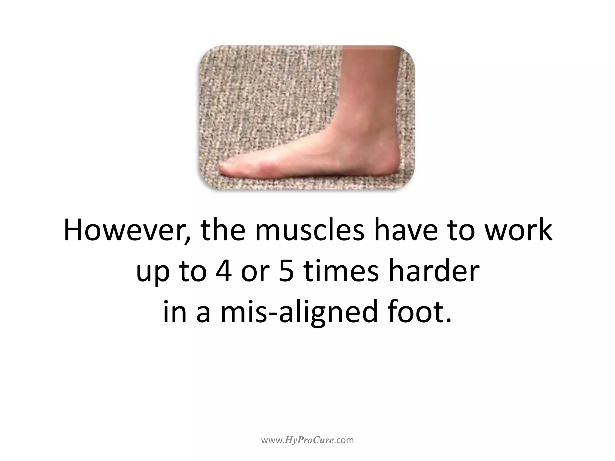 However, the muscles have to work
up to 4 or 5 times harder
in a mis-aligned foot.
 