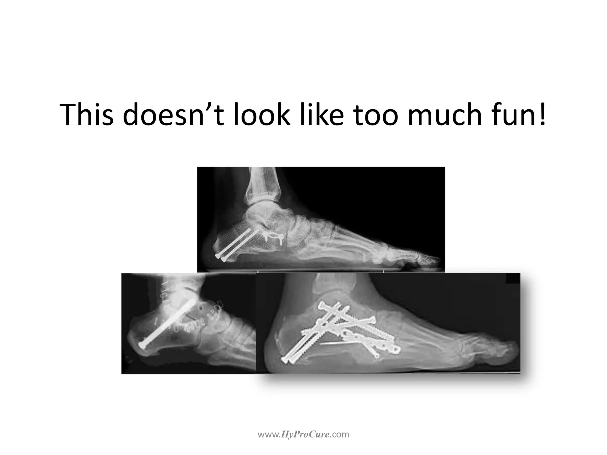 This doesn’t look like too much fun!
 