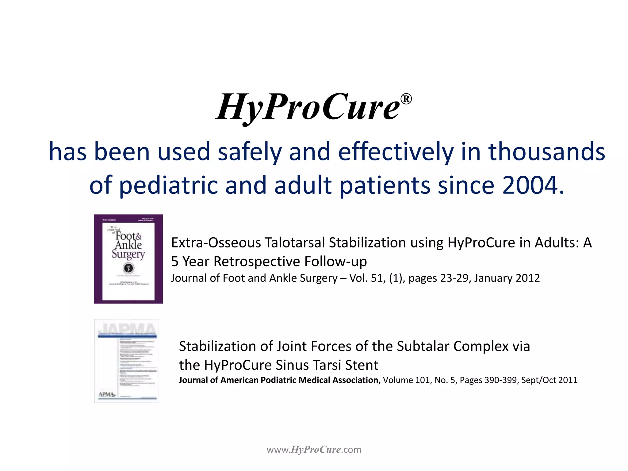 HyProCure®
has been used safely and effectively in thousands
of pediatric and adult patients since 2004.
Stabilization of Joint Forces of the Subtalar Complex via
the HyProCure Sinus Tarsi Stent
Journal of American Podiatric Medical Association, Volume 101, No. 5, Pages 390-399, Sept/Oct 2011
Extra-Osseous Talotarsal Stabilization using HyProCure in Adults: A
5 Year Retrospective Follow-up
Journal of Foot and Ankle Surgery – Vol. 51, (1), pages 23-29, January 2012
 