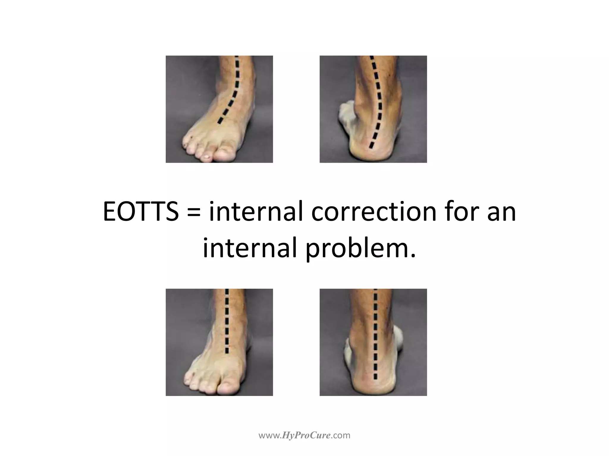EOTTS = internal correction for an
internal problem.
 