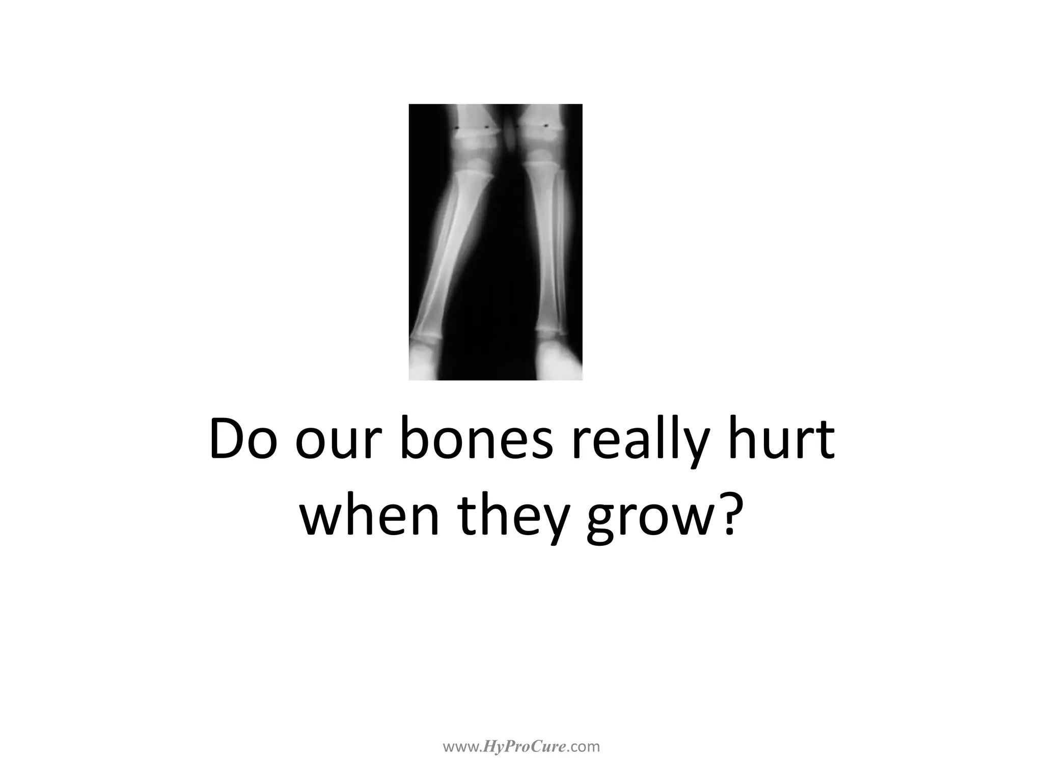 Do our bones really hurt
when they grow?
 