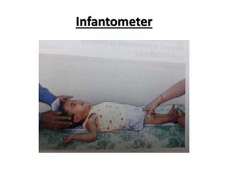 Infantometer
 