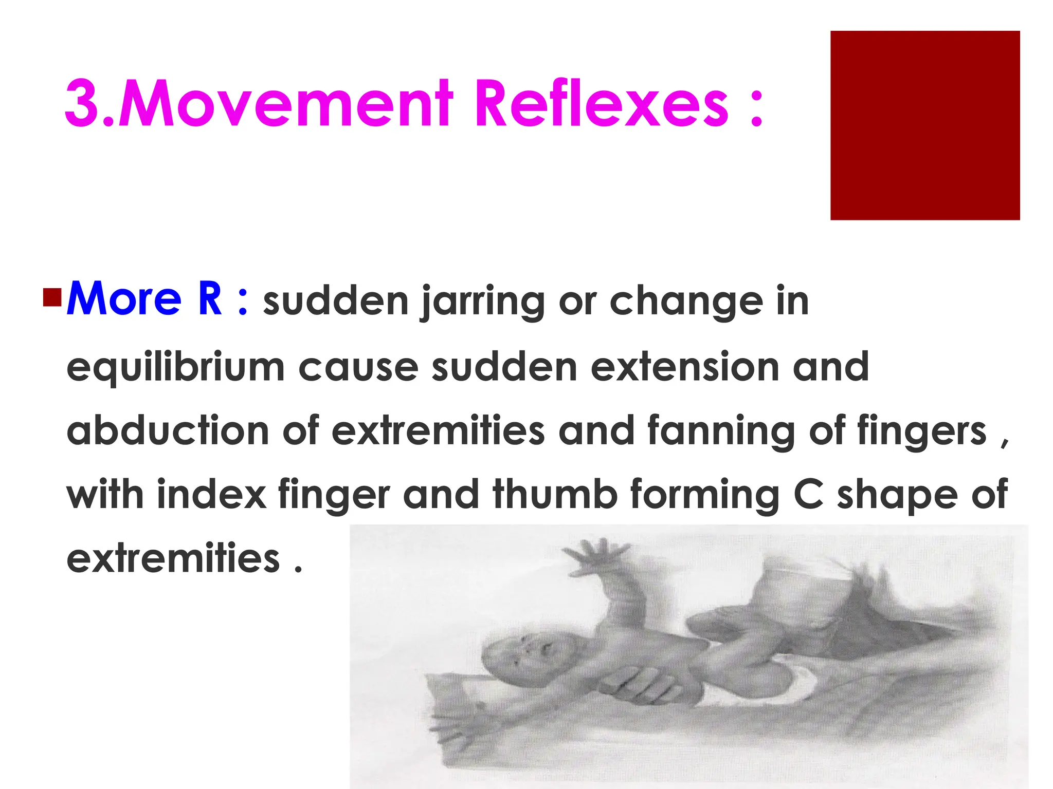 3.Movement Reflexes :
More R : sudden jarring or change in
equilibrium cause sudden extension and
abduction of extremities and fanning of fingers ,
with index finger and thumb forming C shape of
extremities .
 