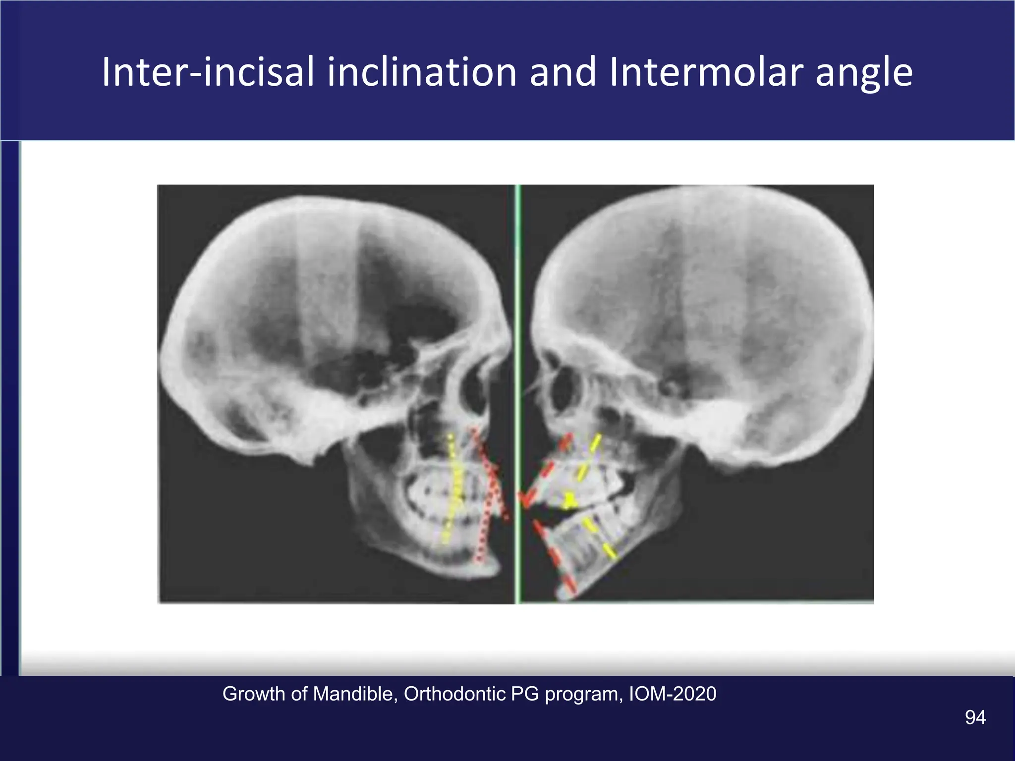 the Growth-of-Mandible in orthodontics ppt | PPT