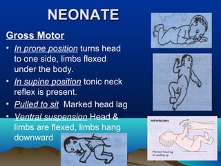 NEONATENEONATE
Gross Motor
• In prone position turns head
to one side, limbs flexed
under the body.
• In supine position tonic neck
reflex is present.
• Pulled to sit Marked head lag
• Ventral suspension Head &
limbs are flexed, limbs hang
downward
 