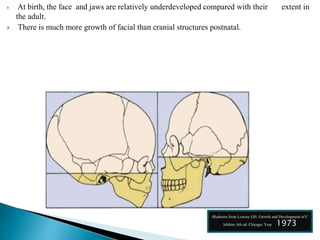  At birth, the face and jaws are relatively underdeveloped compared with their extent in
the adult.
 There is much more growth of facial than cranial structures postnatal.
(Redrawn from Lowery GH. Growth and Development of C
hildren. 6th ed. Chicago: Year 1973
 