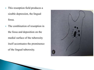  This resorption field produces a
sizable depression, the lingual
fossa.
 The combination of resorption in
the fossa and deposition on the
medial surface of the tuberosity
itself accentuates the prominence
of the lingual tuberosity.
 