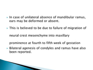  In case of unilateral absence of mandibular ramus,
ears may be deformed or absent.
 This is believed to be due to failure of migration of
neural crest mesenchyme into maxillary
prominence at fourth to fifth week of gestation
 Bilateral agenesis of condyles and ramus have also
been reported.
 