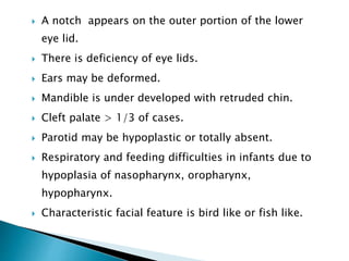  A notch appears on the outer portion of the lower
eye lid.
 There is deficiency of eye lids.
 Ears may be deformed.
 Mandible is under developed with retruded chin.
 Cleft palate > 1/3 of cases.
 Parotid may be hypoplastic or totally absent.
 Respiratory and feeding difficulties in infants due to
hypoplasia of nasopharynx, oropharynx,
hypopharynx.
 Characteristic facial feature is bird like or fish like.
 