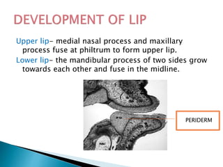 Upper lip- medial nasal process and maxillary
process fuse at philtrum to form upper lip.
Lower lip- the mandibular process of two sides grow
towards each other and fuse in the midline.
PERIDERM
 