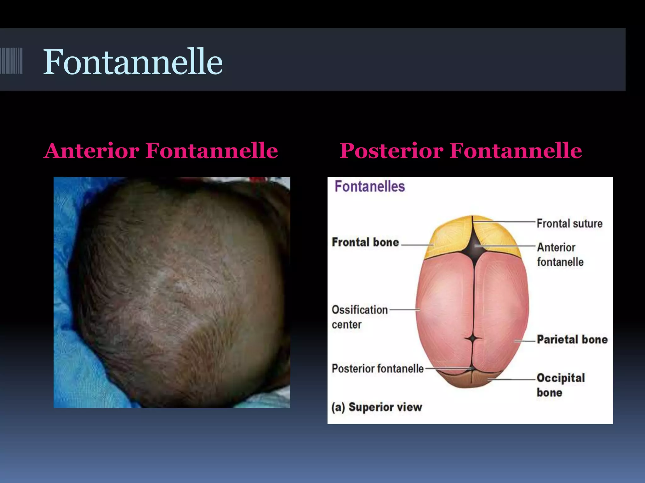 Fontannelle
Anterior Fontannelle Posterior Fontannelle
 