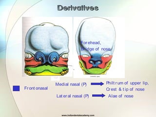 Derivatives
Front onasal
Forehead,
Bridge of nose,
Medial nasal (P) Philt rum of upper lip,
Crest & t ip of nose
Lat eral nasal (P) Alae of nose
www.indiandentalacademy.com
 