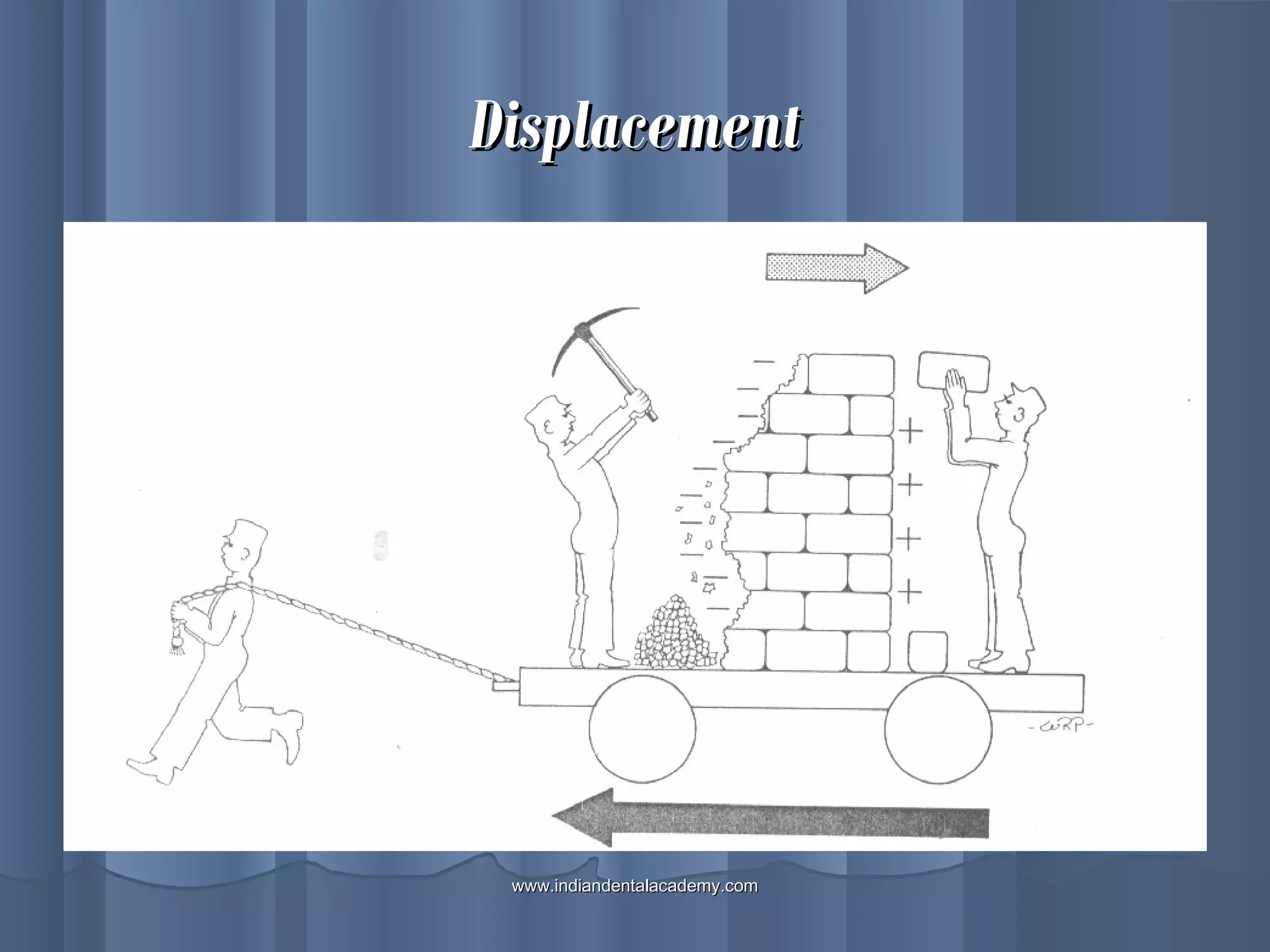 DisplacementDisplacement
www.indiandentalacademy.comwww.indiandentalacademy.com
 