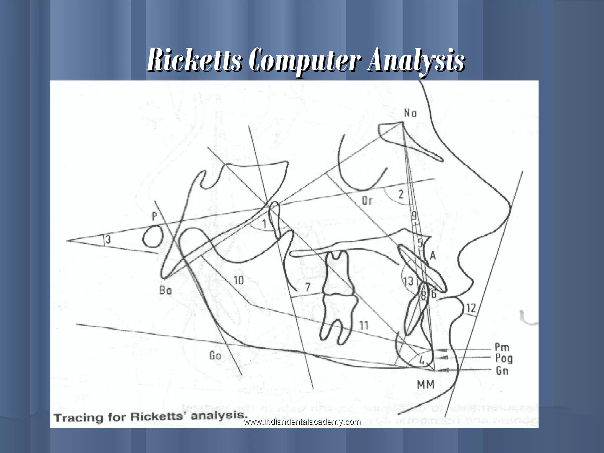 Ricketts Computer AnalysisRicketts Computer Analysis
www.indiandentalacademy.comwww.indiandentalacademy.com
 